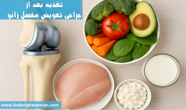 تغذیه بعد از جراحی تعویض مفصل زانو